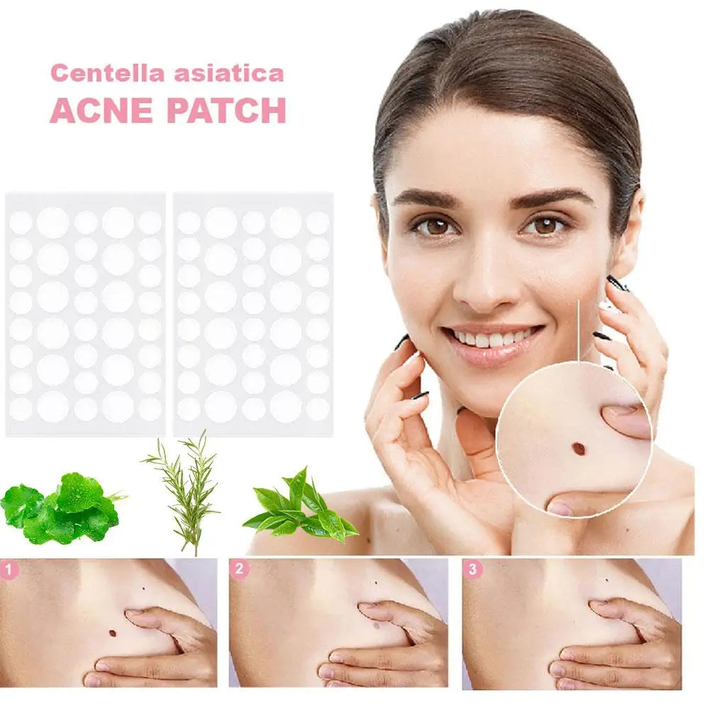 Tea Tree Acne Patches - 72 Pieces